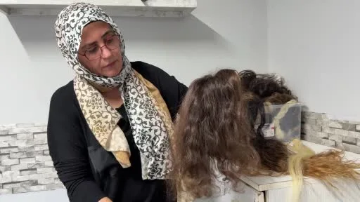 12 yaşında saçlarını ve kulaklarını kaybetti, şimdi kadınlara umut oluyor